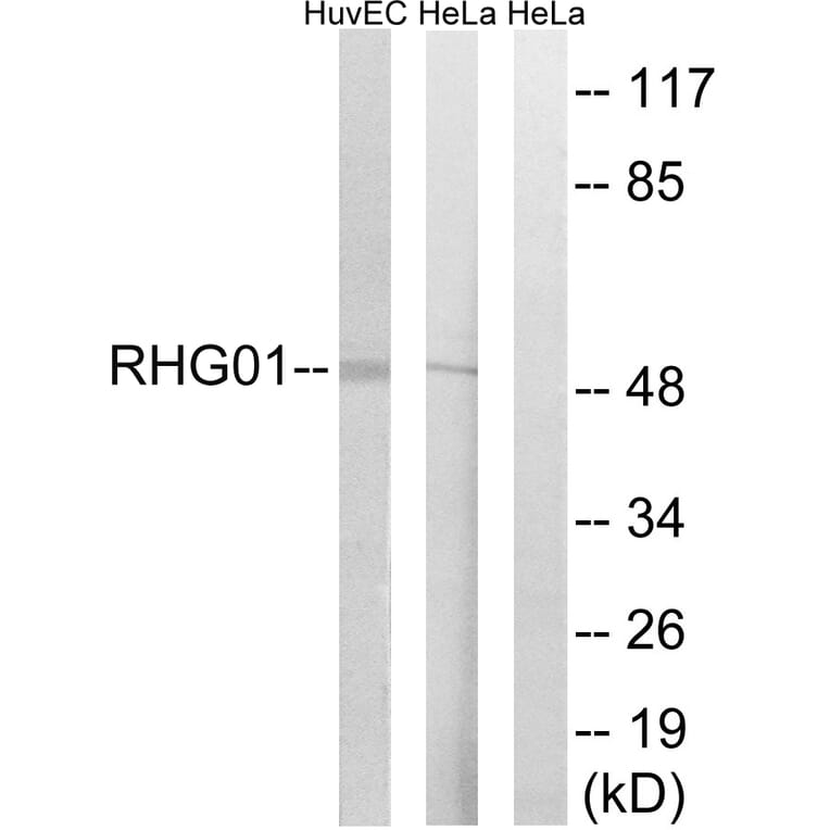 Western Blot - Anti-RHG1 Antibody (C18364) - Antibodies.com