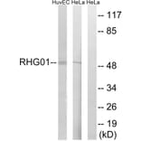 Western Blot - Anti-RHG1 Antibody (C18364) - Antibodies.com