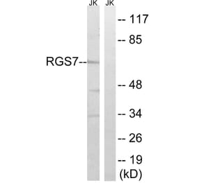 Western Blot - Anti-RGS7 Antibody (C18326) - Antibodies.com