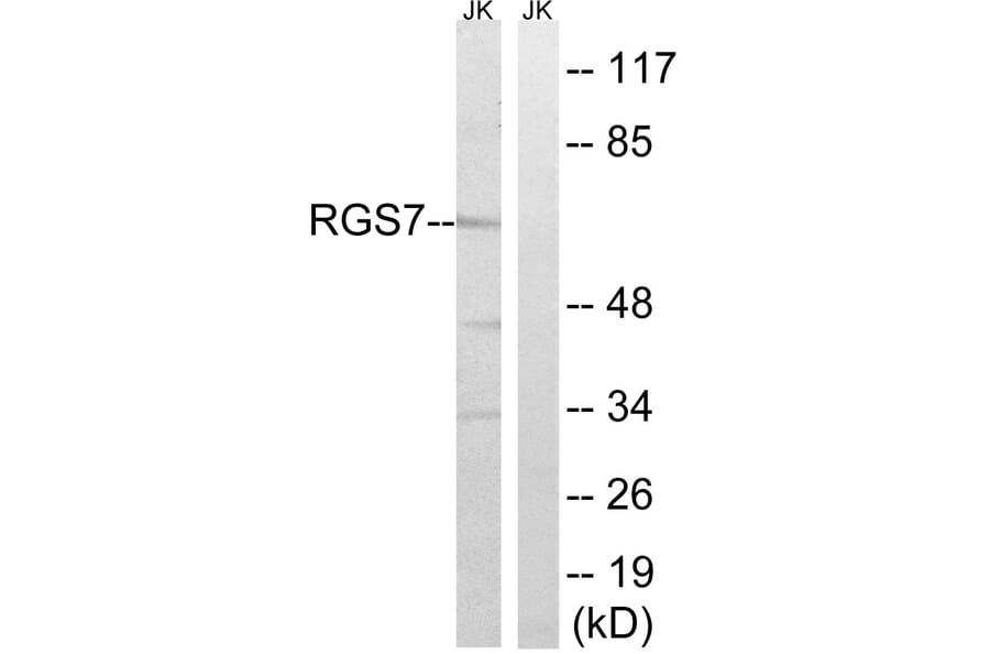 Western Blot - Anti-RGS7 Antibody (C18326) - Antibodies.com