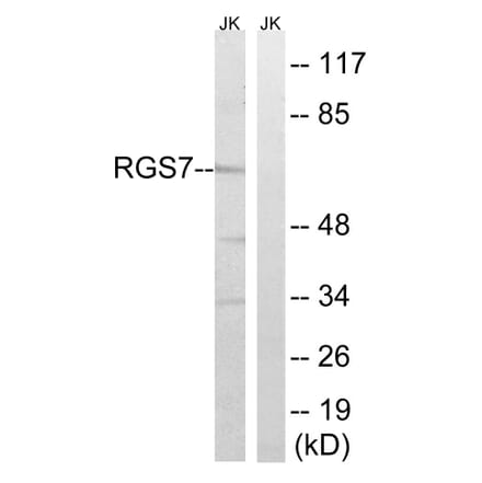 Western Blot - Anti-RGS7 Antibody (C18326) - Antibodies.com