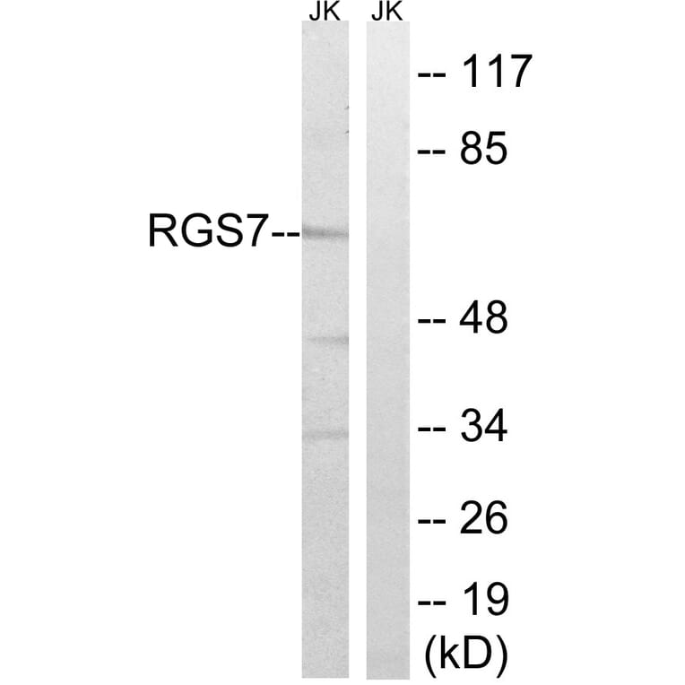 Western Blot - Anti-RGS7 Antibody (C18326) - Antibodies.com