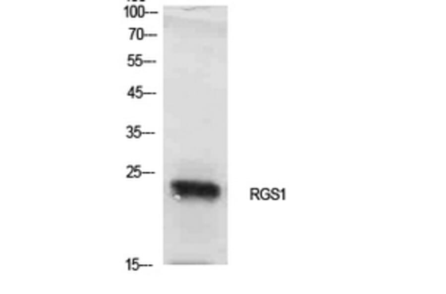 Western Blot - Anti-RGS1 Antibody (C30143) - Antibodies.com