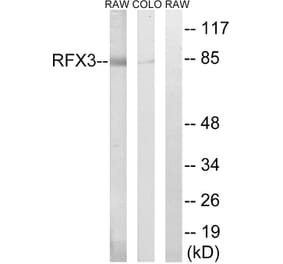 Western Blot - Anti-RFX3 Antibody (C19207) - Antibodies.com