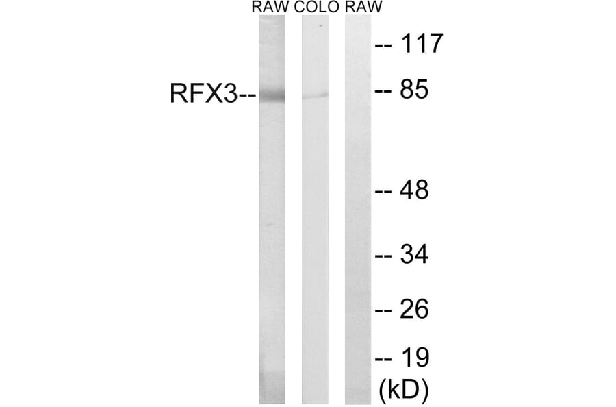 Western Blot - Anti-RFX3 Antibody (C19207) - Antibodies.com