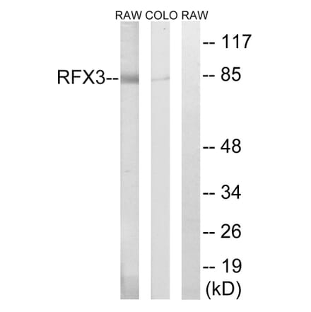 Western Blot - Anti-RFX3 Antibody (C19207) - Antibodies.com