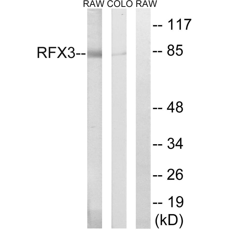 Western Blot - Anti-RFX3 Antibody (C19207) - Antibodies.com