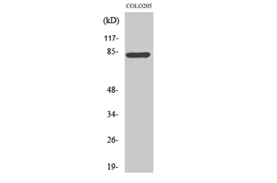 Western Blot - Anti-RFX3 Antibody (C19207) - Antibodies.com