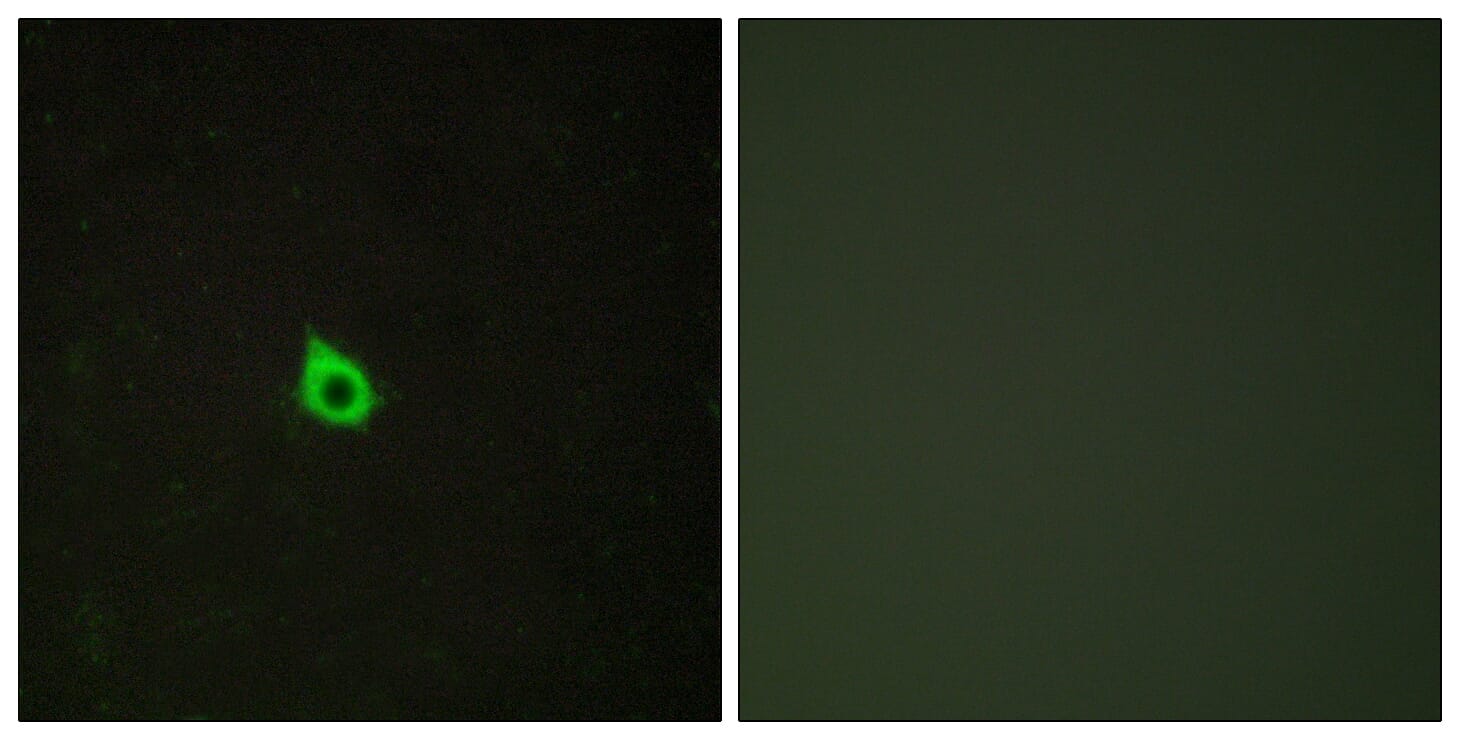 Immunofluorescence analysis of HepG2 cells using Anti-RECK Antibody. The right hand panel represents a negative control, where the antibody was pre-incubated with the immunising peptide.