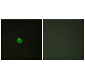 Immunofluorescence - Anti-RECK Antibody (C10249) - Antibodies.com