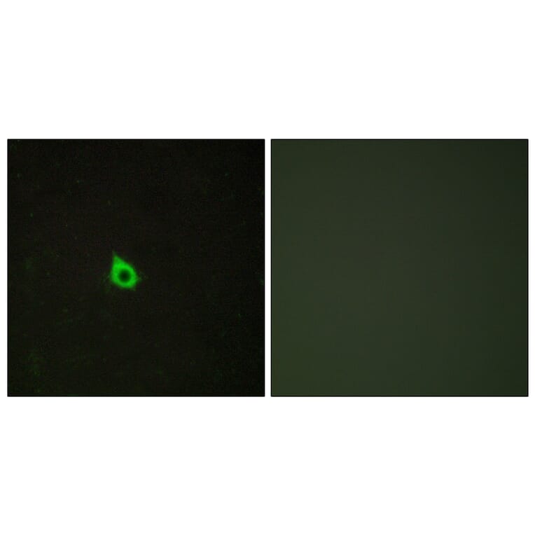 Immunofluorescence - Anti-RECK Antibody (C10249) - Antibodies.com