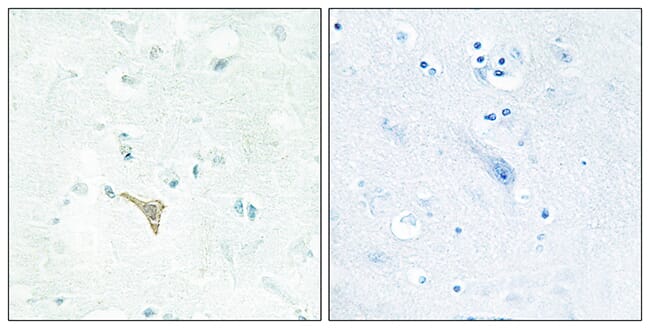 Immunohistochemical analysis of paraffin-embedded human brain tissue using Anti-RECK Antibody. The right hand panel represents a negative control, where the antibody was pre-incubated with the immunising peptide.
