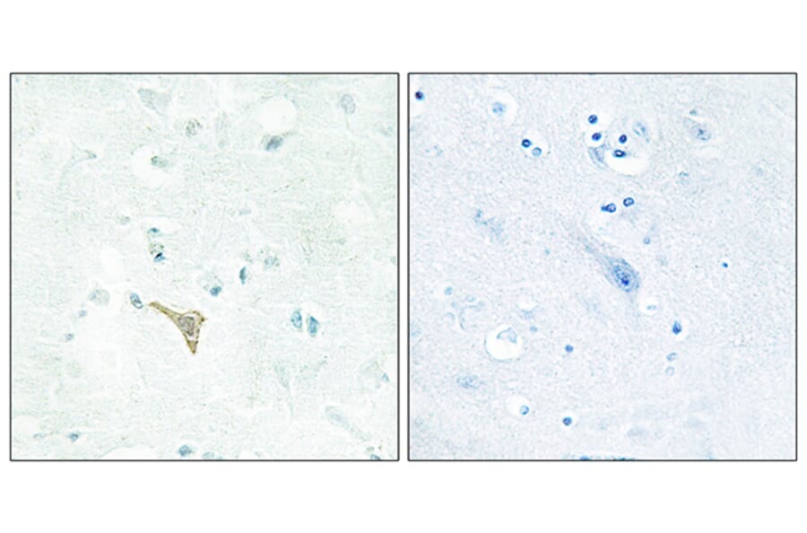 Immunohistochemistry - Anti-RECK Antibody (C10249) - Antibodies.com