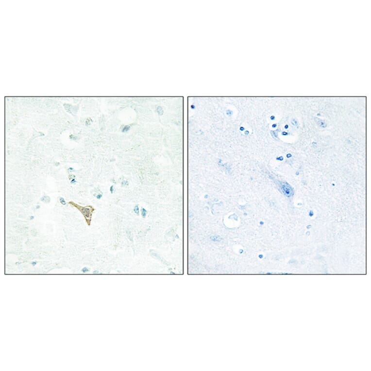 Immunohistochemistry - Anti-RECK Antibody (C10249) - Antibodies.com