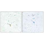 Immunohistochemistry - Anti-RECK Antibody (C10249) - Antibodies.com