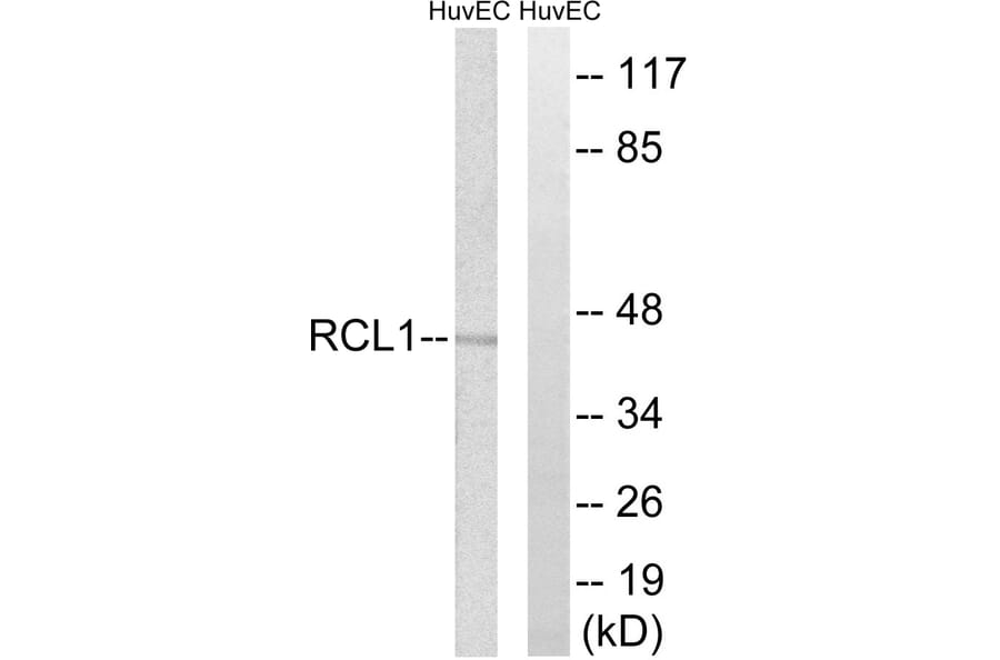 Western Blot - Anti-RCL1 Antibody (C18444) - Antibodies.com