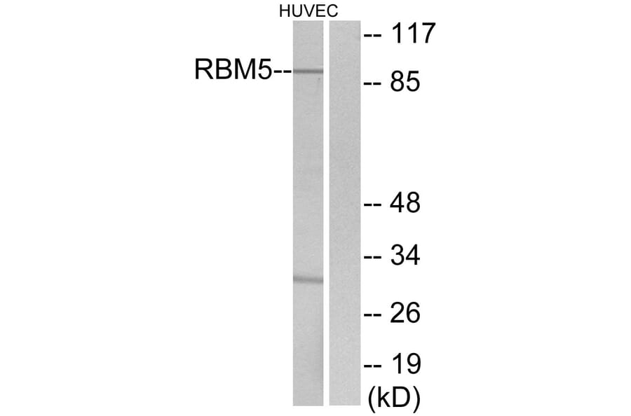 Western Blot - Anti-RBM5 Antibody (C10706) - Antibodies.com