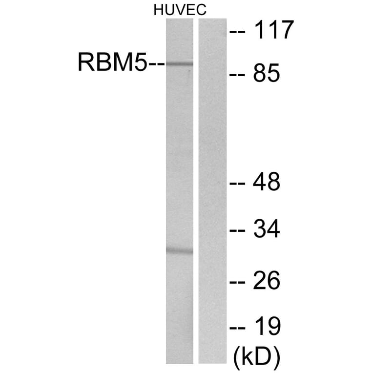 Western Blot - Anti-RBM5 Antibody (C10706) - Antibodies.com