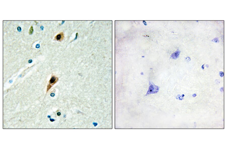 Immunohistochemistry - Anti-RBM5 Antibody (C10706) - Antibodies.com