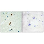 Immunohistochemistry - Anti-RBM5 Antibody (C10706) - Antibodies.com