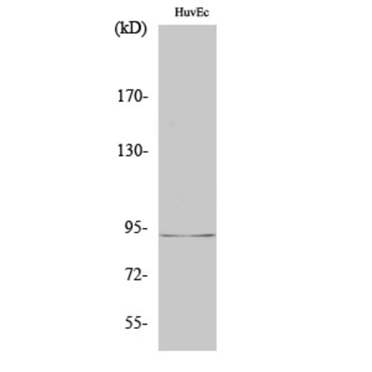 Western Blot - Anti-RBM5 Antibody (C10706) - Antibodies.com
