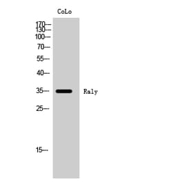 Western Blot - Anti-RALY Antibody (C20573) - Antibodies.com