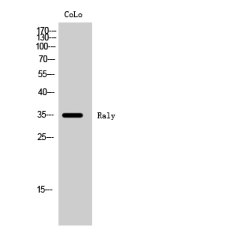 Western Blot - Anti-RALY Antibody (C20573) - Antibodies.com