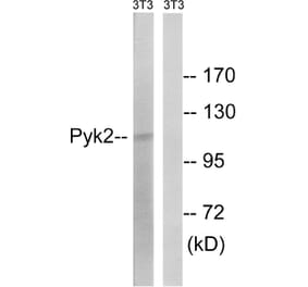 Western Blot - Anti-PYK2 Antibody (B8260) - Antibodies.com