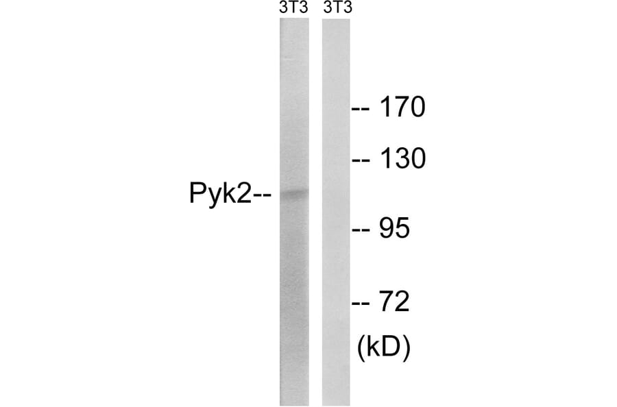 Western Blot - Anti-PYK2 Antibody (B8260) - Antibodies.com