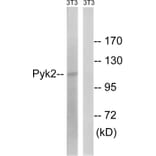 Western Blot - Anti-PYK2 Antibody (B8260) - Antibodies.com