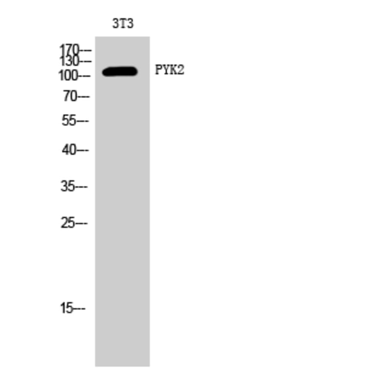 Western Blot - Anti-PYK2 Antibody (B8260) - Antibodies.com