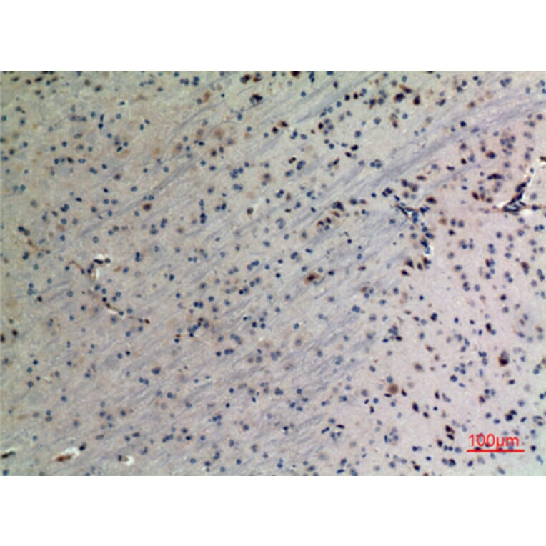 Immunohistochemistry - Anti-PPID Antibody (C30012) - Antibodies.com