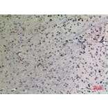 Immunohistochemistry - Anti-PPID Antibody (C30012) - Antibodies.com