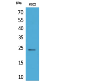 Western Blot - Anti-PPIB Antibody (C30049) - Antibodies.com