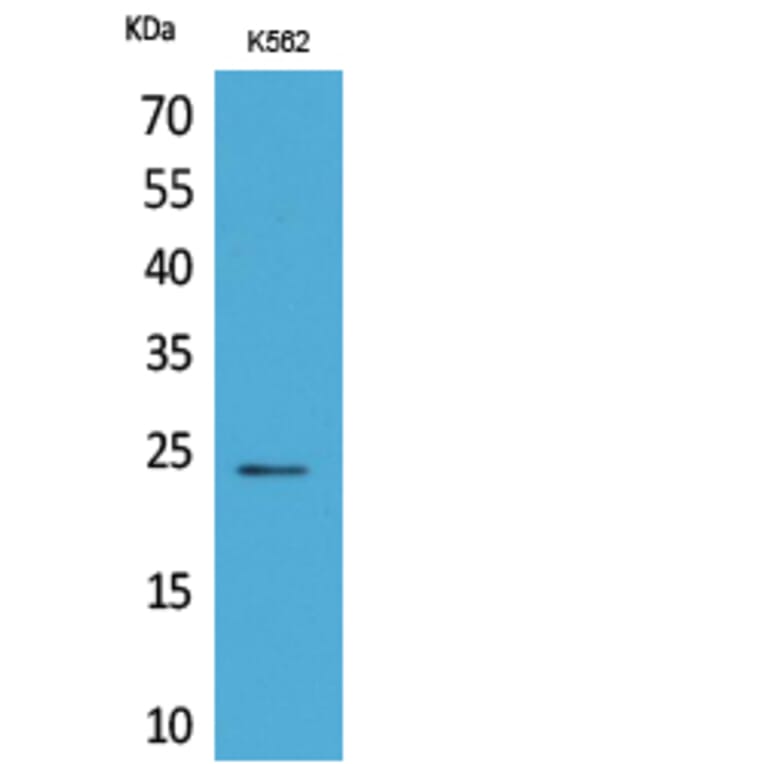 Western Blot - Anti-PPIB Antibody (C30049) - Antibodies.com