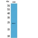 Western Blot - Anti-PPIB Antibody (C30049) - Antibodies.com