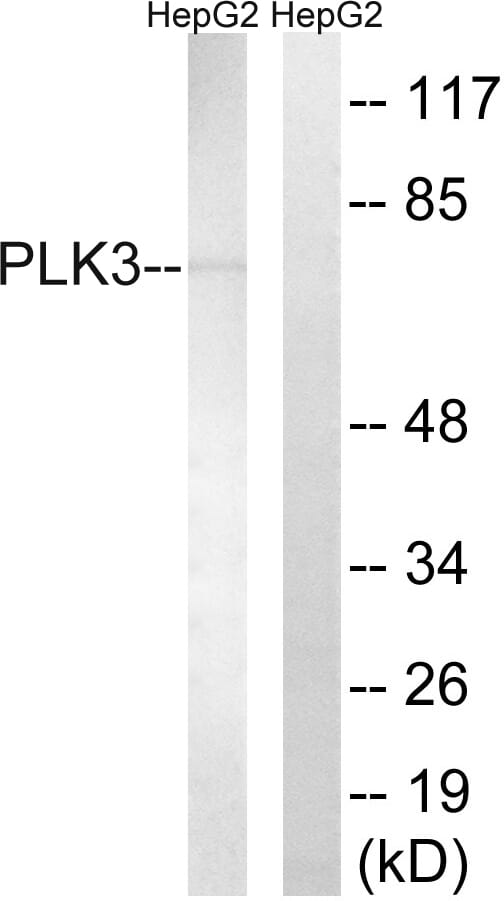 Western blot analysis of lysates from HepG2 cells using Anti-PLK3 Antibody. The right hand lane represents a negative control, where the antibody is blocked by the immunising peptide.