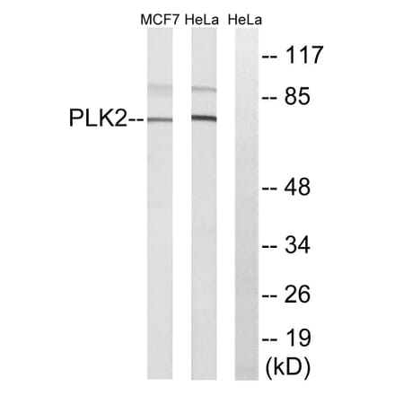 Western Blot - Anti-PLK2 Antibody (C18597) - Antibodies.com