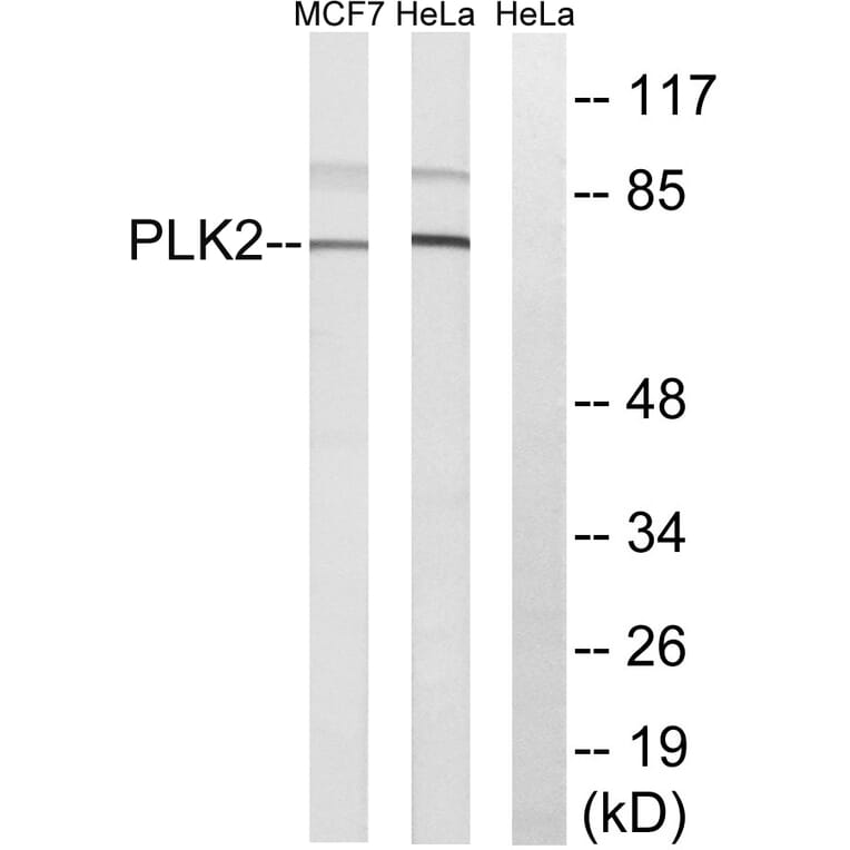 Western Blot - Anti-PLK2 Antibody (C18597) - Antibodies.com
