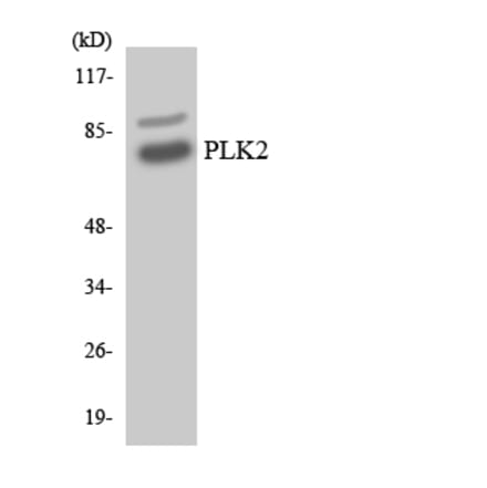 Western Blot - Anti-PLK2 Antibody (R12-3337) - Antibodies.com