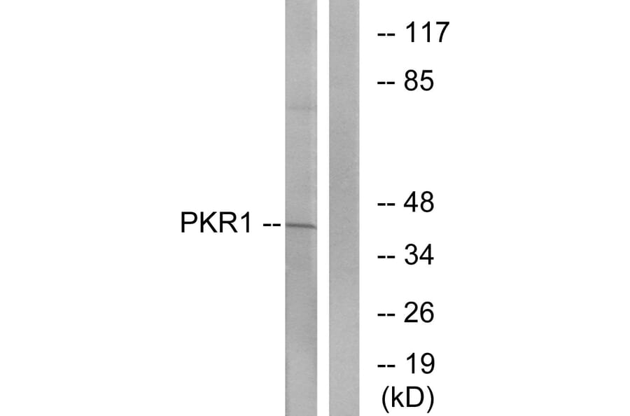Western Blot - Anti-PKR1 Antibody (G726) - Antibodies.com