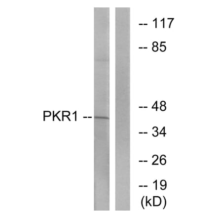 Western Blot - Anti-PKR1 Antibody (G726) - Antibodies.com