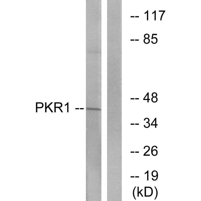 Western Blot - Anti-PKR1 Antibody (G726) - Antibodies.com