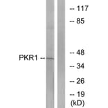 Western Blot - Anti-PKR1 Antibody (G726) - Antibodies.com