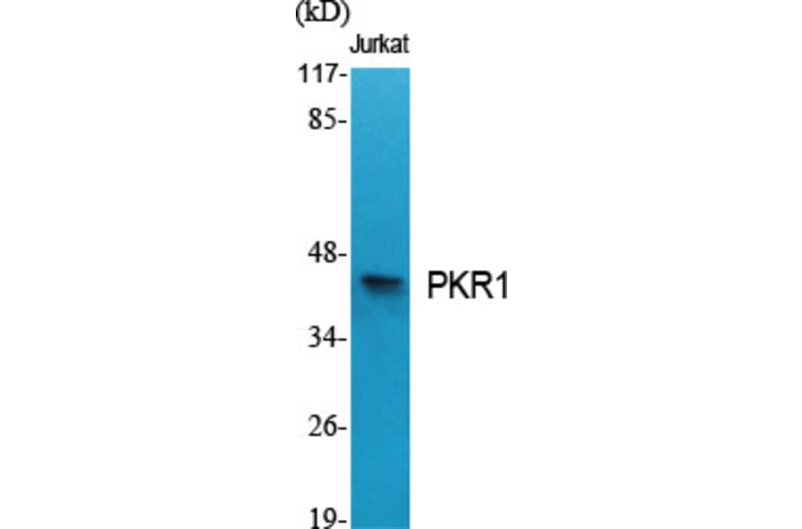 Western Blot - Anti-PKR1 Antibody (G726) - Antibodies.com