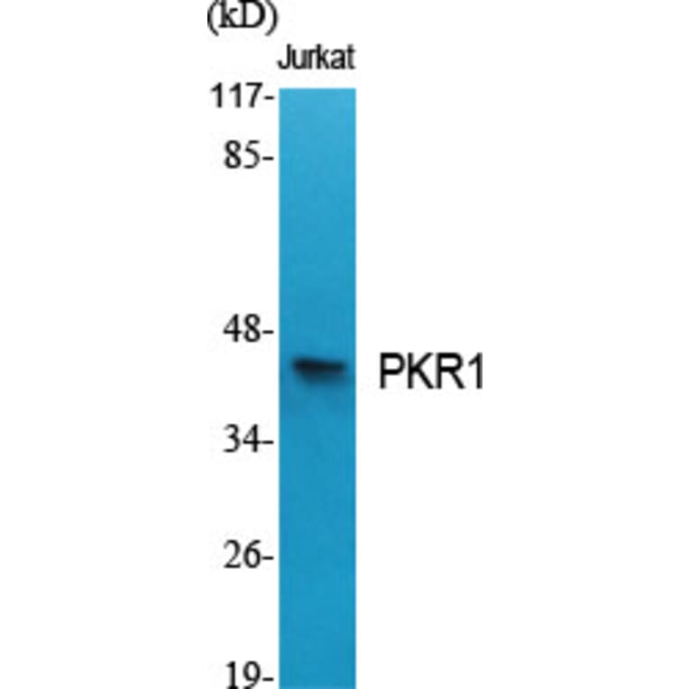 Western Blot - Anti-PKR1 Antibody (G726) - Antibodies.com