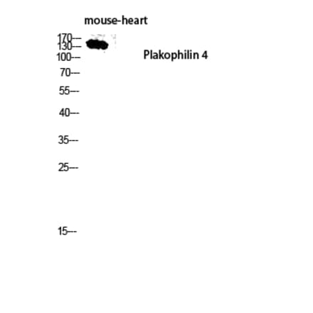 Western Blot - Anti-PKP4 Antibody (C17733) - Antibodies.com