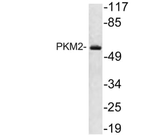 Western Blot - Anti-PKM2 Antibody (R12-2313) - Antibodies.com
