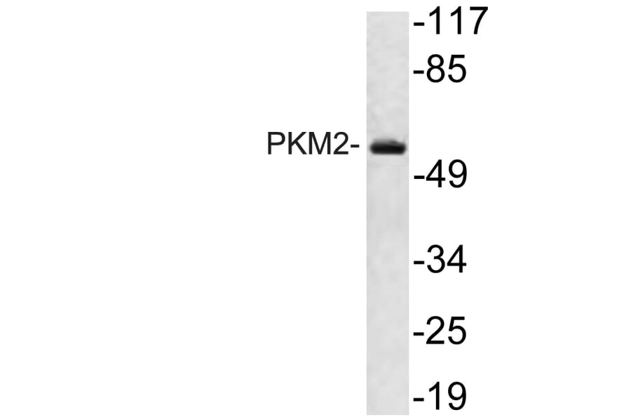 Western Blot - Anti-PKM2 Antibody (R12-2313) - Antibodies.com