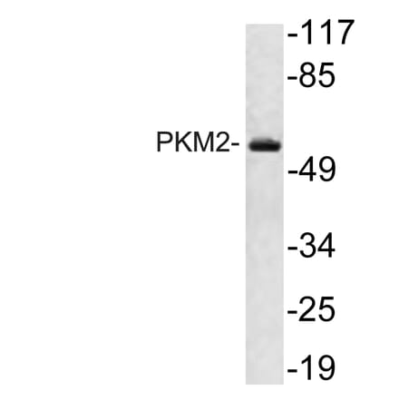 Western Blot - Anti-PKM2 Antibody (R12-2313) - Antibodies.com